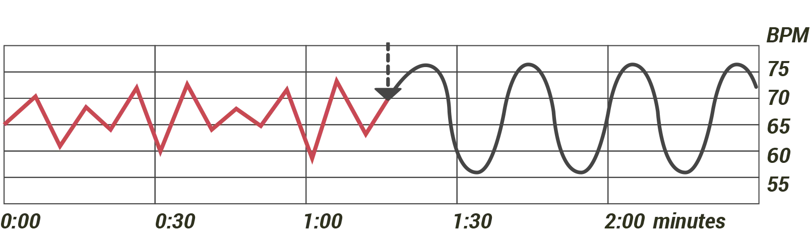 Courbe de variabilité cardiaque stabilisée après 1 minute de cohérence cardiaque